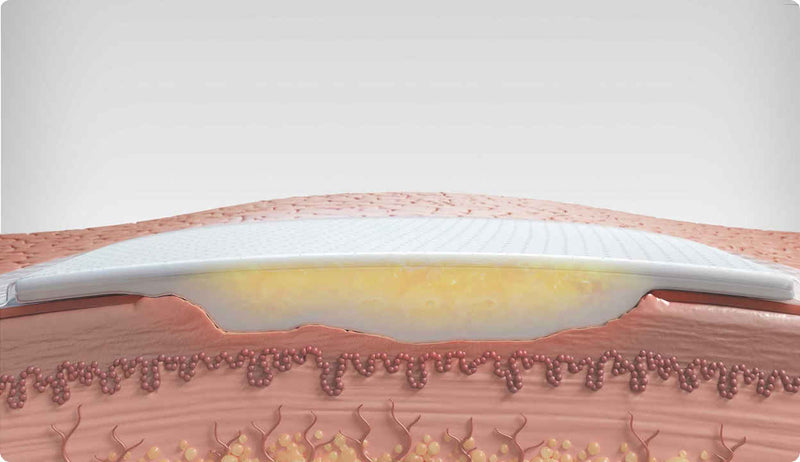 Biatain Silicone Foam Dressing (10x20 cm) – Box of 5