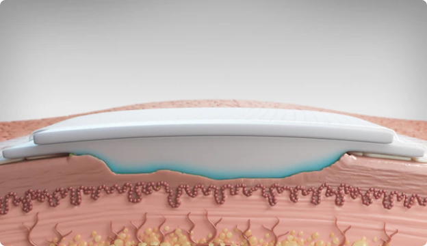 Biatain Silicone Foam Dressing (10x20 cm) – Box of 5